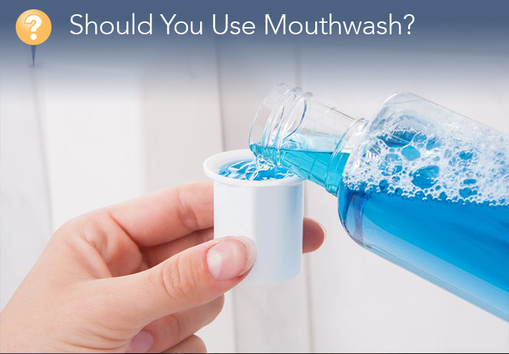 Should You Use Mouthwash?