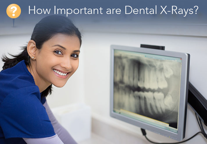 Understanding the Importance of Dental X-Rays