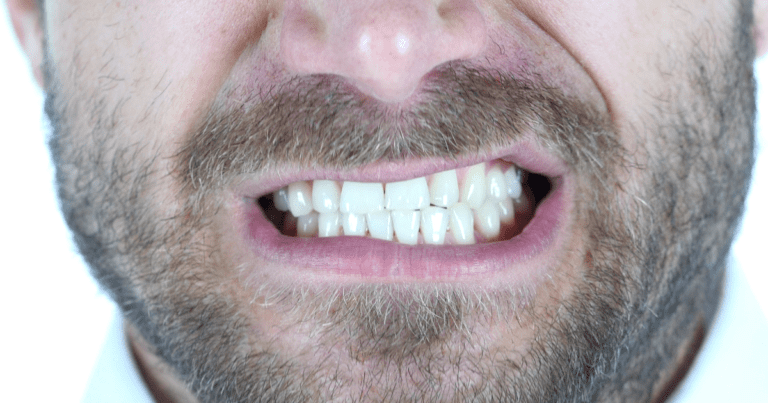 Close-up of a man's mouth with his teeth clenched