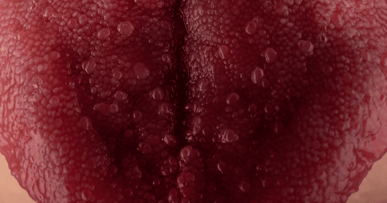 Oral Cancer Screening