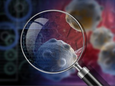 VELscope for Oral Cancer Detection