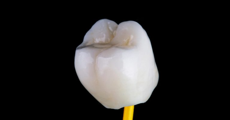 Porcelain Crown