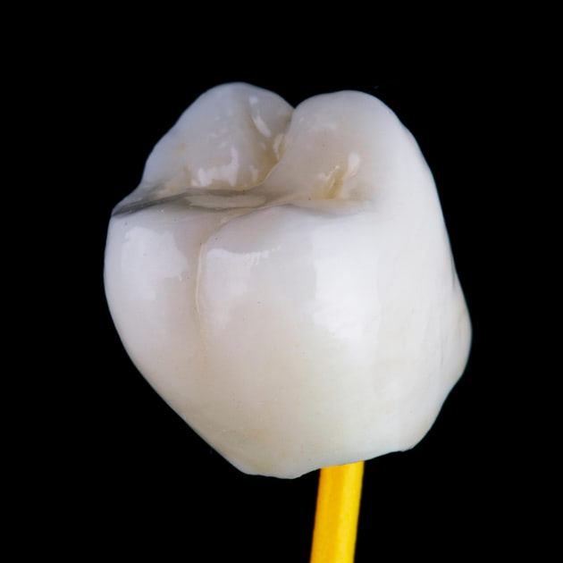 Porcelain Crown