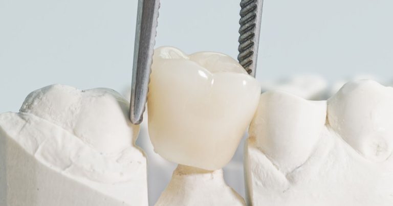 Zirconia Crown